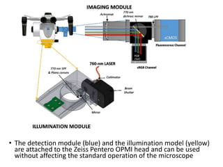 • The detection module (blue) and the illumination model (yellow)
are attached to the Zeiss Pentero OPMI head and can be used
without affecting the standard operation of the microscope
 