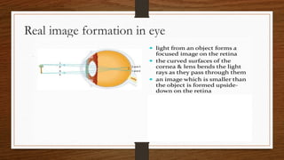Real image formation in eye
 