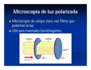 Microscopía de luz polarizada
Microscopio de campo claro con filtros que
polarizan la luz
Útil para materiales birrefringentes