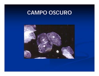 CAMPO OSCURO