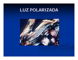 LUZ POLARIZADA