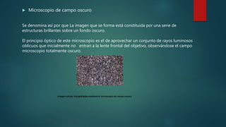  Microscopio de campo oscuro
Se denomina así por que La imagen que se forma está constituida por una serie de
estructuras brillantes sobre un fondo oscuro.
El principio óptico de este microscopio es el de aprovechar un conjunto de rayos luminosos
oblicuos que inicialmente no entran a la lente frontal del objetivo, observándose el campo
microscopio totalmente oscuro.
. Imagen células, fotografiadas mediante el microscopio de campo oscuro.
 