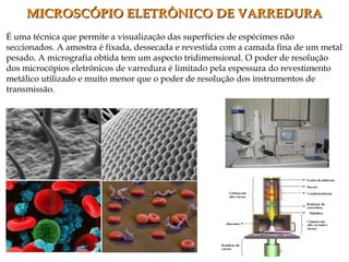 É uma técnica que permite a visualização das superfícies de espécimes não
seccionados. A amostra é fixada, dessecada e revestida com a camada fina de um metal
pesado. A micrografia obtida tem um aspecto tridimensional. O poder de resolução
dos microcópios eletrônicos de varredura é limitado pela espessura do revestimento
metálico utilizado e muito menor que o poder de resolução dos instrumentos de
transmissão.
MICROSCÓPIO ELETRÔNICO DE VARREDURAMICROSCÓPIO ELETRÔNICO DE VARREDURA
 