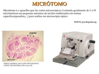 Micrótomo é o aparelho que faz cortes microscópicos (variando geralmente de 1 à 10
micrómetros) em pequenas amostras de tecidos emblocadas em resinas
específicas(parafina,...) para análise em microscópio óptico.
FONTE: pt.wikipedia.org
MICRÓTOMOMICRÓTOMO
NERVO NORMAL INCLUÍDO EM PARAFINA
CORTE TRANSVERSAL DE 6 mm, HE.
 