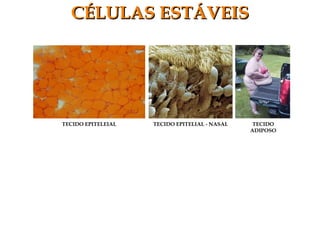 CÉLULAS ESTÁVEISCÉLULAS ESTÁVEIS
TECIDO EPITELEIAL TECIDO
ADIPOSO
TECIDO EPITELIAL - NASAL
 