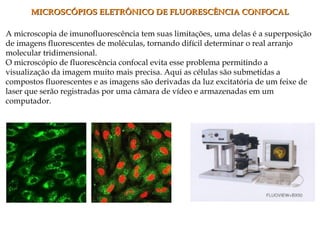 A microscopia de imunofluorescência tem suas limitações, uma delas é a superposição
de imagens fluorescentes de moléculas, tornando difícil determinar o real arranjo
molecular tridimensional.
O microscópio de fluorescência confocal evita esse problema permitindo a
visualização da imagem muito mais precisa. Aqui as células são submetidas a
compostos fluorescentes e as imagens são derivadas da luz excitatória de um feixe de
laser que serão registradas por uma câmara de vídeo e armazenadas em um
computador.
MICROSCÓPIOS ELETRÔNICO DE FLUORESCÊNCIA CONFOCALMICROSCÓPIOS ELETRÔNICO DE FLUORESCÊNCIA CONFOCAL
 