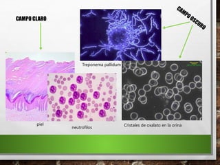 Treponema pallidum
Cristales de oxalato en la orina
piel
CAMPO CLARO
CAMPOOSCURO
neutrofilos
 