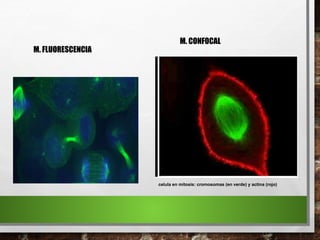 celula en mitosis: cromosomas (en verde) y actina (rojo)
M. FLUORESCENCIA
M. CONFOCAL
 