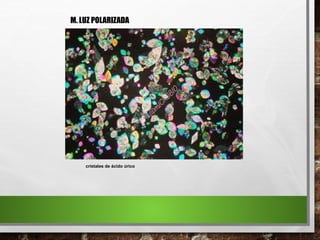 cristales de ácido úrico
M. LUZ POLARIZADA
 