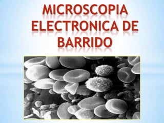 MICROSCOPIA
ELECTRONICA DE
BARRIDO
 