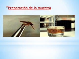*Preparación de la muestra:
 