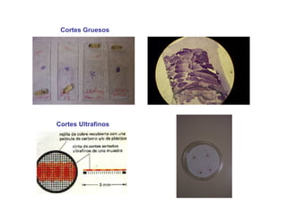 Cortes Gruesos
Cortes Ultrafinos
 
