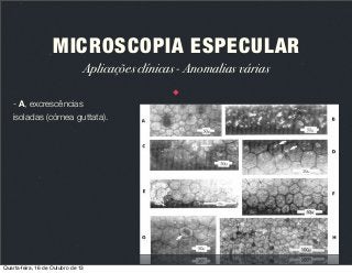 MICROSCOPIA ESPECULAR
Aplicações clínicas - Anomalias várias
- A, excrescências
isoladas (córnea guttata).

Quarta-feira, 16 de Outubro de 13

 
