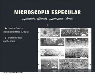 MICROSCOPIA ESPECULAR
Aplicações clínicas - Anomalias várias
- A, excrescências
isoladas (córnea guttata).
- B, excrescências
conﬂuentes.

Quarta-feira, 16 de Outubro de 13

 
