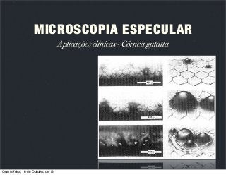 MICROSCOPIA ESPECULAR
Aplicações clínicas - Córnea gutatta

Quarta-feira, 16 de Outubro de 13

 