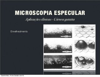 MICROSCOPIA ESPECULAR
Aplicações clínicas - Córnea gutatta
Envelhecimento

Quarta-feira, 16 de Outubro de 13

 