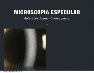 MICROSCOPIA ESPECULAR
Aplicações clínicas - Córnea gutatta

Quarta-feira, 16 de Outubro de 13

 