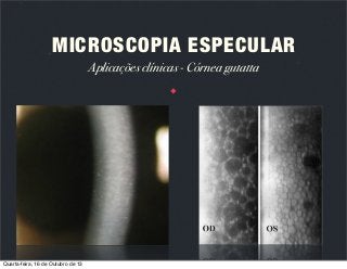 MICROSCOPIA ESPECULAR
Aplicações clínicas - Córnea gutatta

Quarta-feira, 16 de Outubro de 13

 