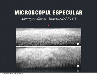 MICROSCOPIA ESPECULAR
Aplicações clínicas - Implante de LIO CA

Quarta-feira, 16 de Outubro de 13

 