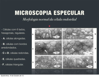 MICROSCOPIA ESPECULAR
Tipos de microscópios

Quarta-feira, 16 de Outubro de 13

 