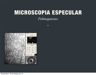 MICROSCOPIA ESPECULAR
Tipos de microscópios
CONTACTO

NÃO CONTACTO

Quarta-feira, 16 de Outubro de 13

Consiste num microscópio com uma lente que
aplana a córnea, reduzindo assim a sua curvatura e
aumentando a área de reﬂexo especular.
Utilizam tecnologia de focagem de imagem
automatizada. A córnea não sofre aplanação.

 