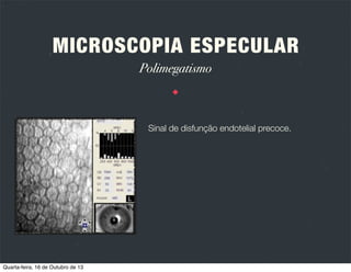 MICROSCOPIA ESPECULAR
Tipos de microscópios
CONTACTO

NÃO CONTACTO

Consiste num microscópio com uma lente que
aplana a córnea, reduzindo assim a sua curvatura e
aumentando a área de reﬂexo especular.
Utilizam tecnologia de focagem de imagem
automatizada. A córnea não sofre aplanação.

Ambos utilizam sistemas computorizados de captura de
imagem e análise da morfologia da célula endotelial.

Quarta-feira, 16 de Outubro de 13

 