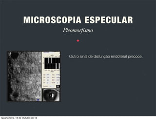 MICROSCOPIA ESPECULAR
Tipos de microscópios
TA C T
NÃO CON
C O N TA C T

O

◆

Keeler Instruments
model SP-580

◆

HAI Labs
model CL-1000xyz

◆

TOMEY Corp.
model EM-1000

Quarta-feira, 16 de Outubro de 13

O

 