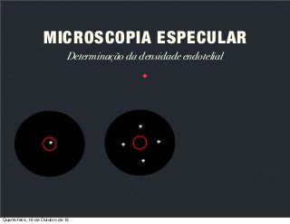MICROSCOPIA ESPECULAR
Determinação da densidade endotelial

*
*

*

*
*

Quarta-feira, 16 de Outubro de 13

 