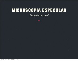 MICROSCOPIA ESPECULAR
Endotélio normal

Quarta-feira, 16 de Outubro de 13

 