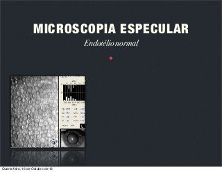 MICROSCOPIA ESPECULAR
Endotélio normal

Quarta-feira, 16 de Outubro de 13

 