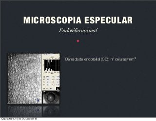 MICROSCOPIA ESPECULAR
Endotélio normal

Densidade endotelial (CD): nº células/mm2

Quarta-feira, 16 de Outubro de 13

 