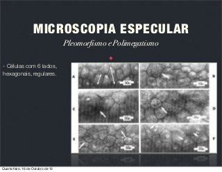 MICROSCOPIA ESPECULAR
Pleomorfismo e Polimegatismo
- Células com 6 lados,
hexagonais, regulares.

Quarta-feira, 16 de Outubro de 13

 