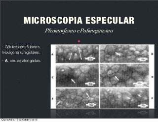 MICROSCOPIA ESPECULAR
Pleomorfismo e Polimegatismo
- Células com 6 lados,
hexagonais, regulares.
- A, células alongadas.

Quarta-feira, 16 de Outubro de 13

 