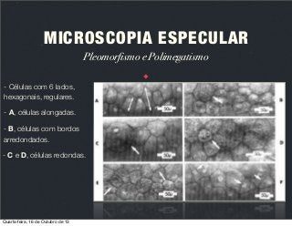 MICROSCOPIA ESPECULAR
Pleomorfismo e Polimegatismo
- Células com 6 lados,
hexagonais, regulares.
- A, células alongadas.
- B, células com bordos
arredondados.
- C e D, células redondas.

Quarta-feira, 16 de Outubro de 13

 