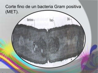 Corte fino de un bacteria Gram positiva
(MET).
 