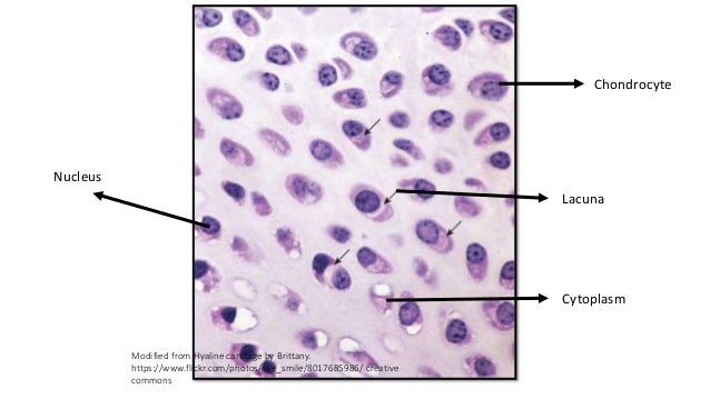 Hyaline Cartilage Labeled Diagram