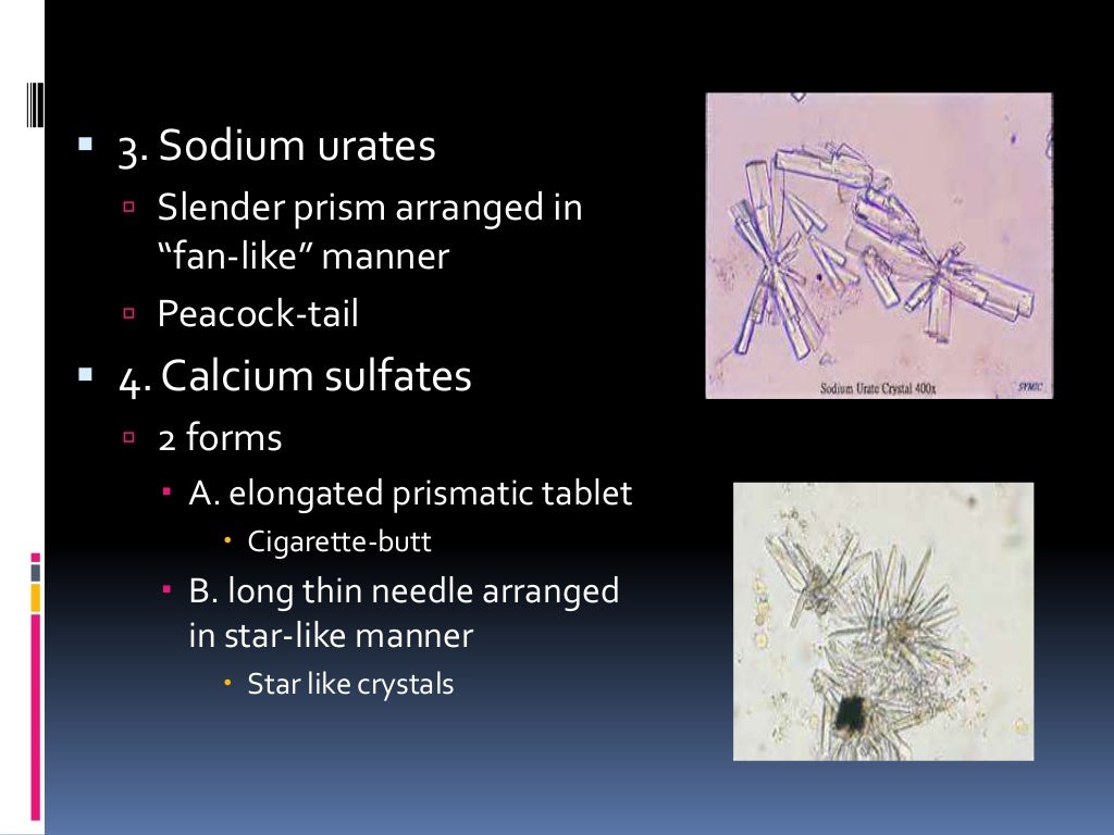 Microscopic examination of urinary sediments