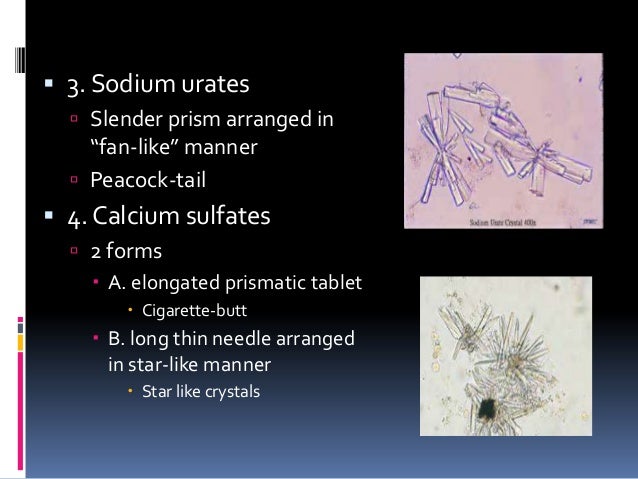Microscopic examination of urinary sediments