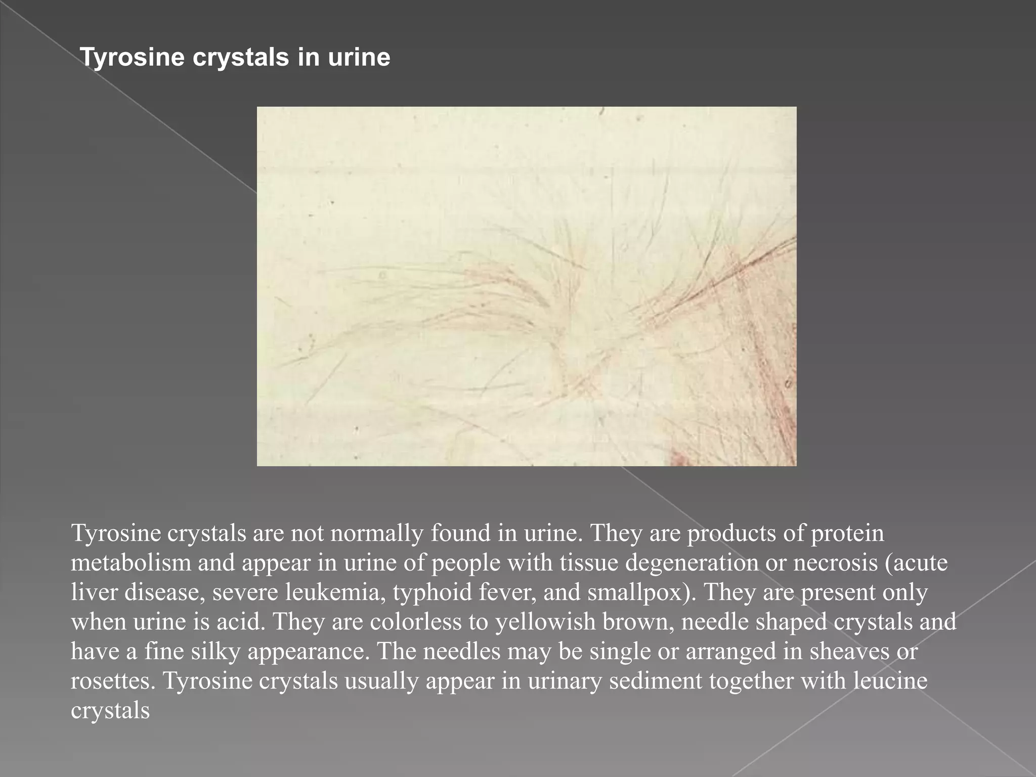 Microscopic examination of urine | PPTX
