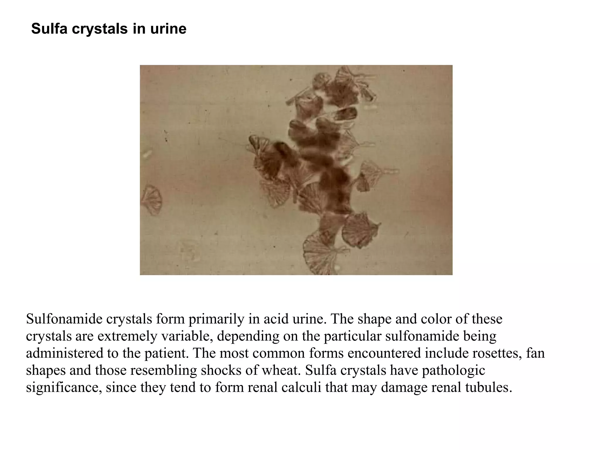 Microscopic examination of urine | PPTX