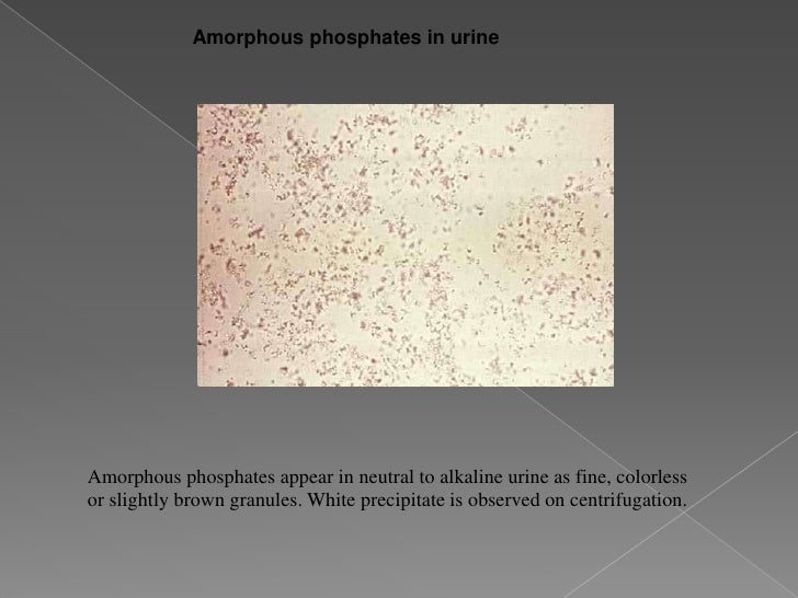 Microscopic examination of urine