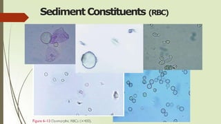 Sediment Constituents (RBC)
 
