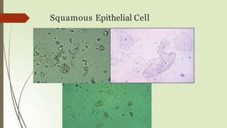 Squamous Epithelial Cell
 