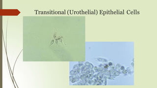 Transitional (Urothelial) Epithelial Cells
 
