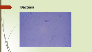 Bacteria
 
