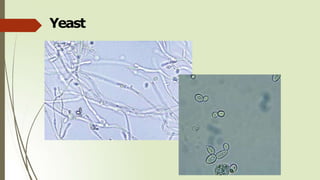 Yeast
 