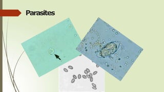 Parasites
 