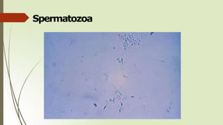 Spermatozoa
 