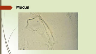 Mucus
 
