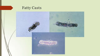 Fatty Casts
 